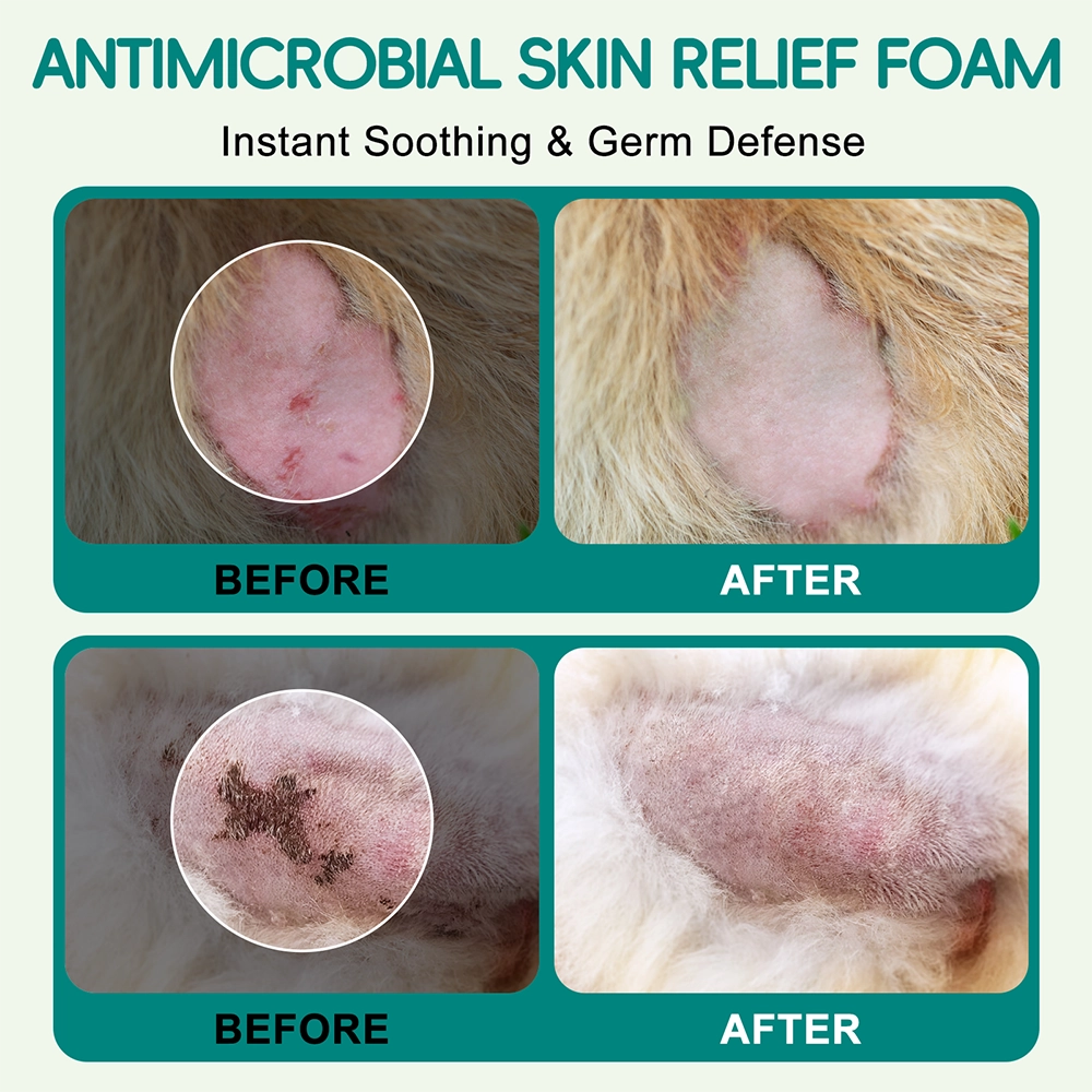 Antimicrobial Skin Relief Foam